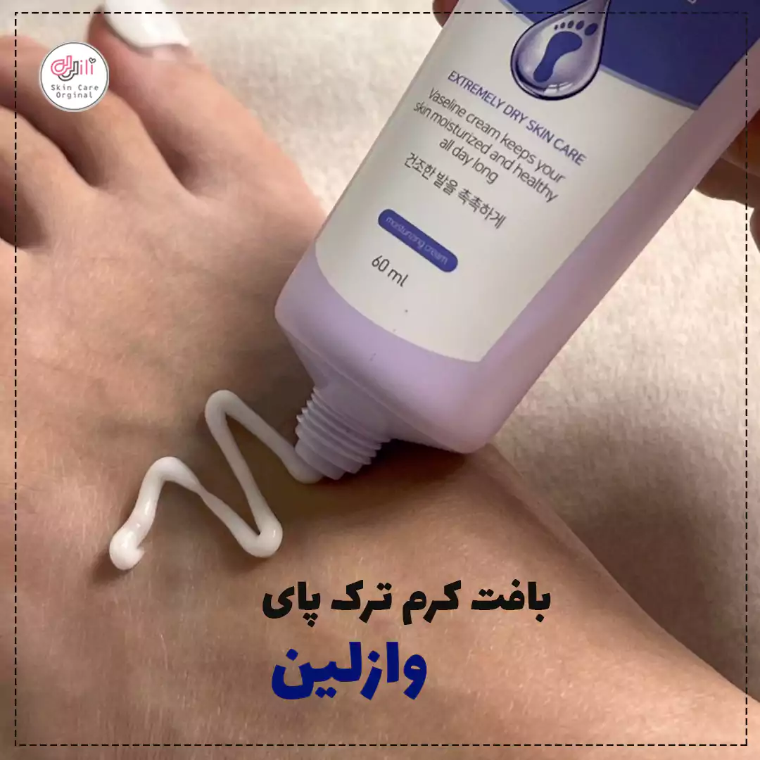 درمان ترک پاشنه پا با کرم وازلین