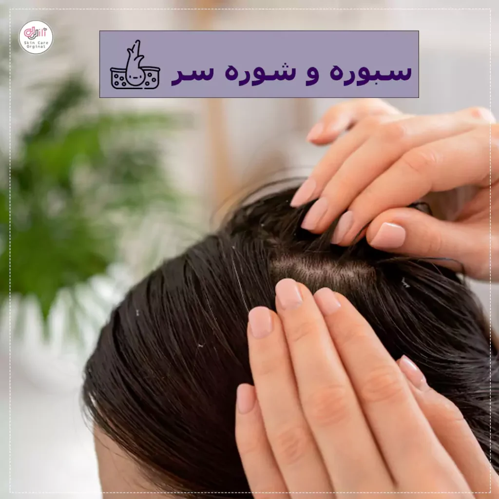 سبوره و شوره سر