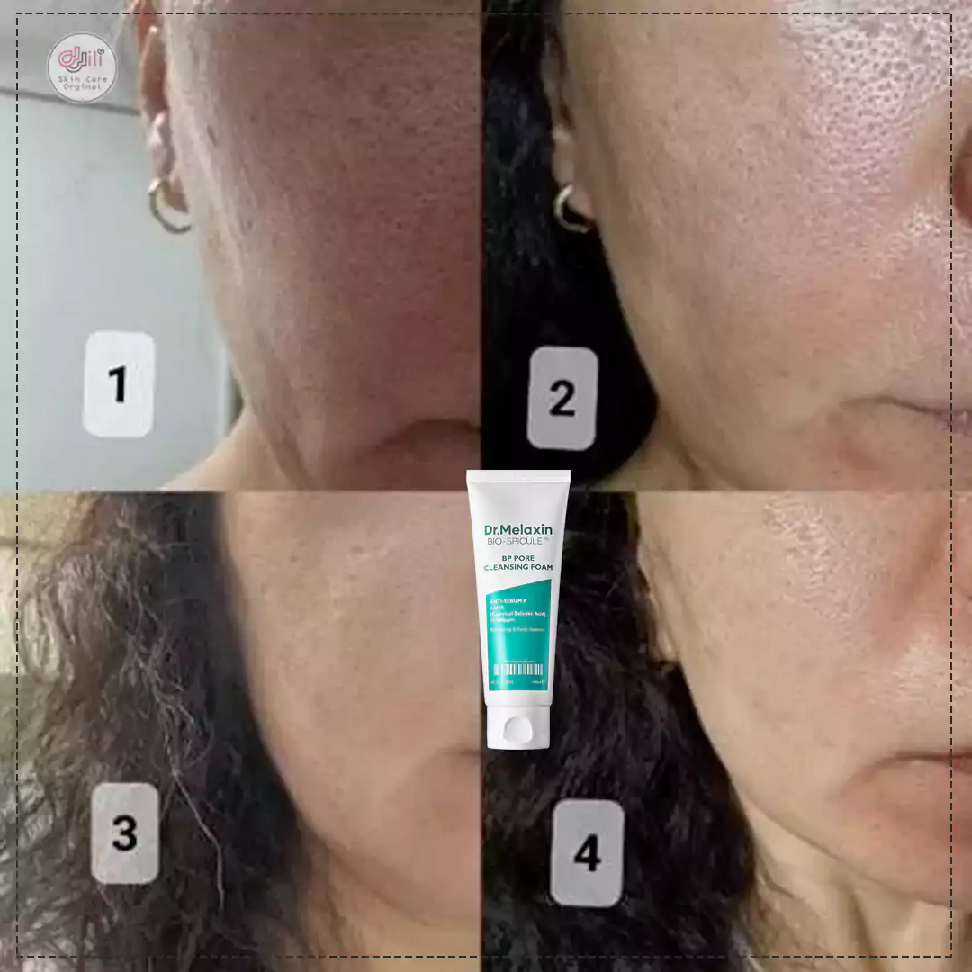 تاثیر شوینده دکتر ملاکسین