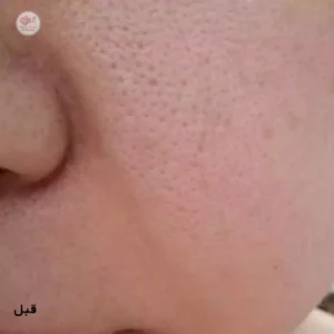 قبل