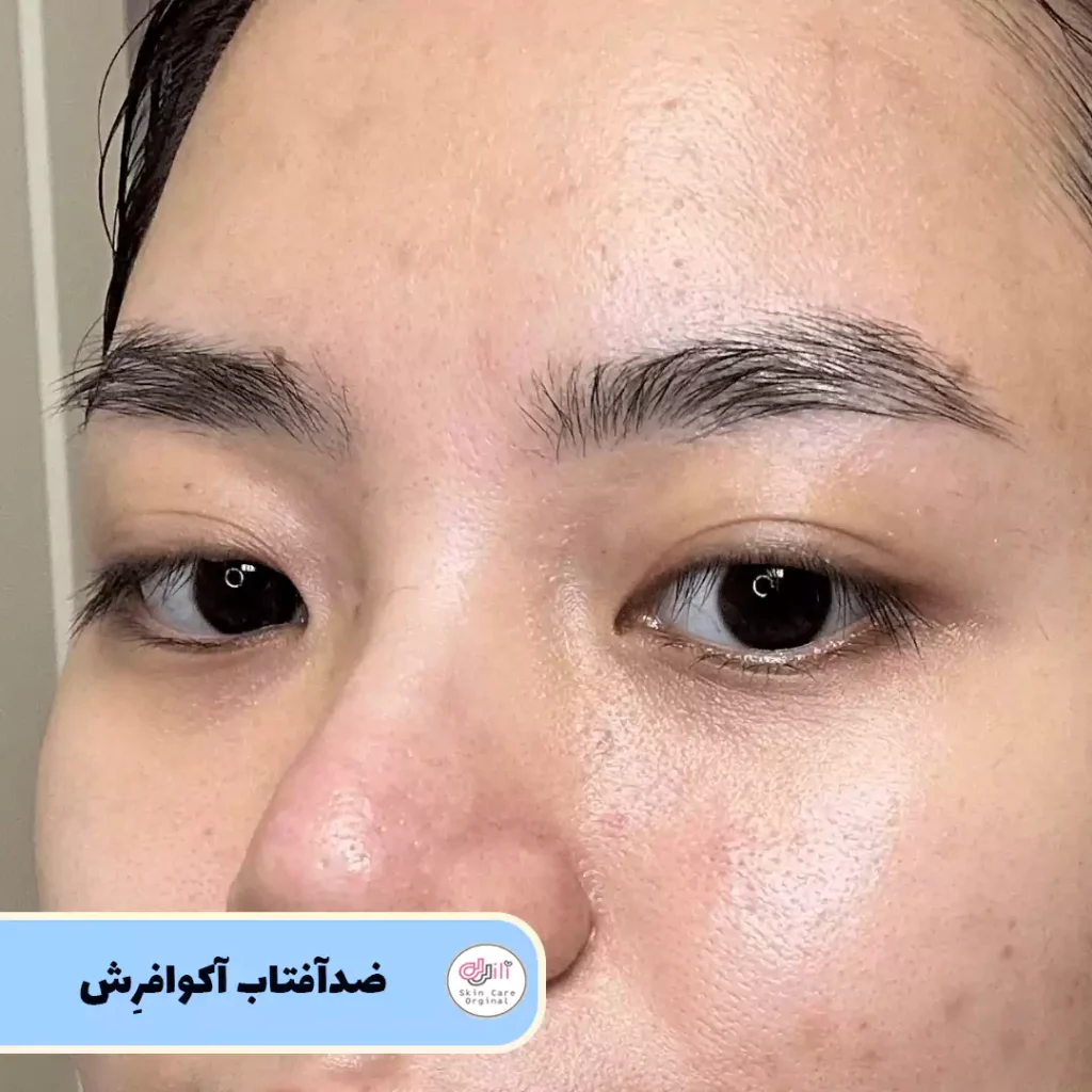 ضدآفتاب اکوا فرش