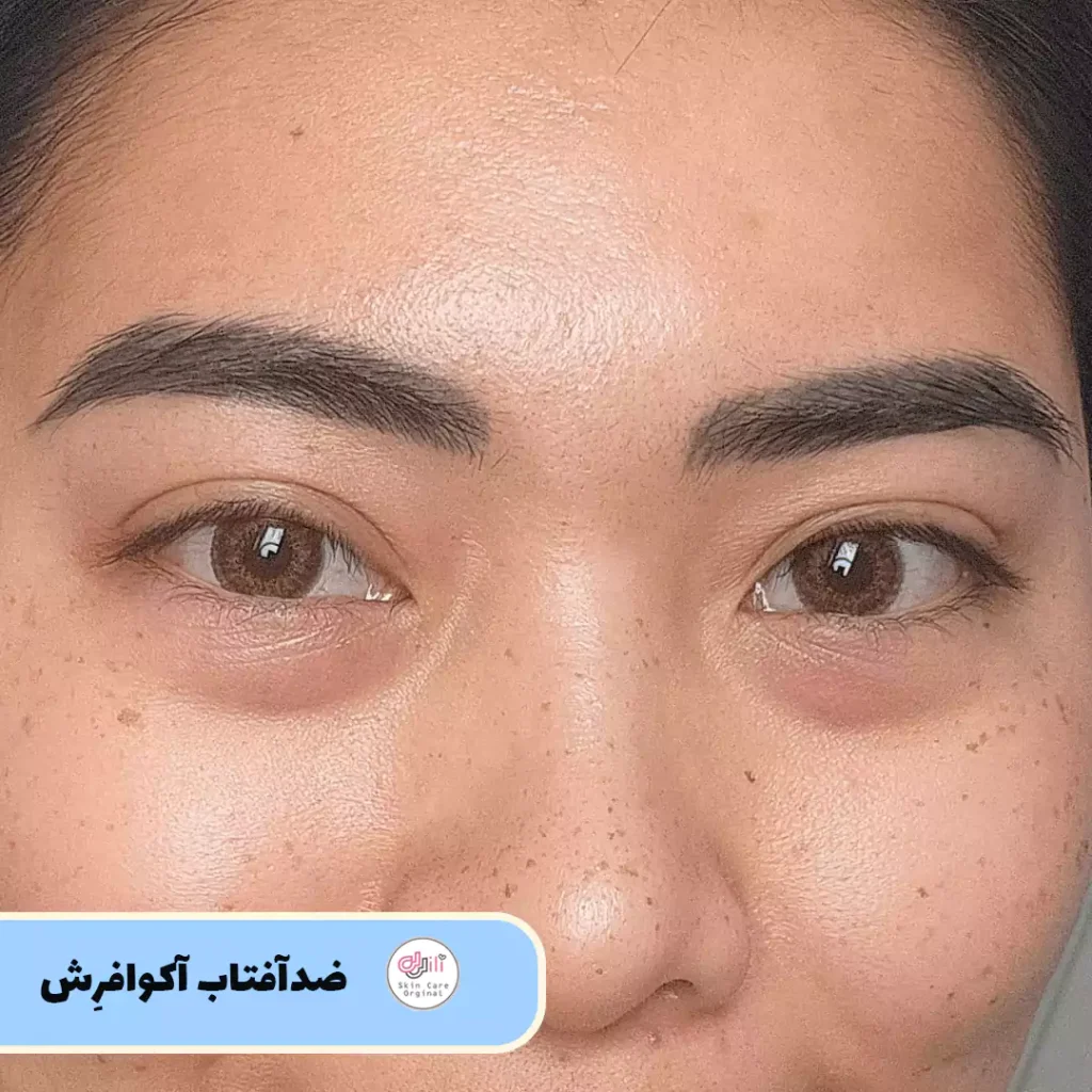 فینیش ضدآفتاب آکوافرش