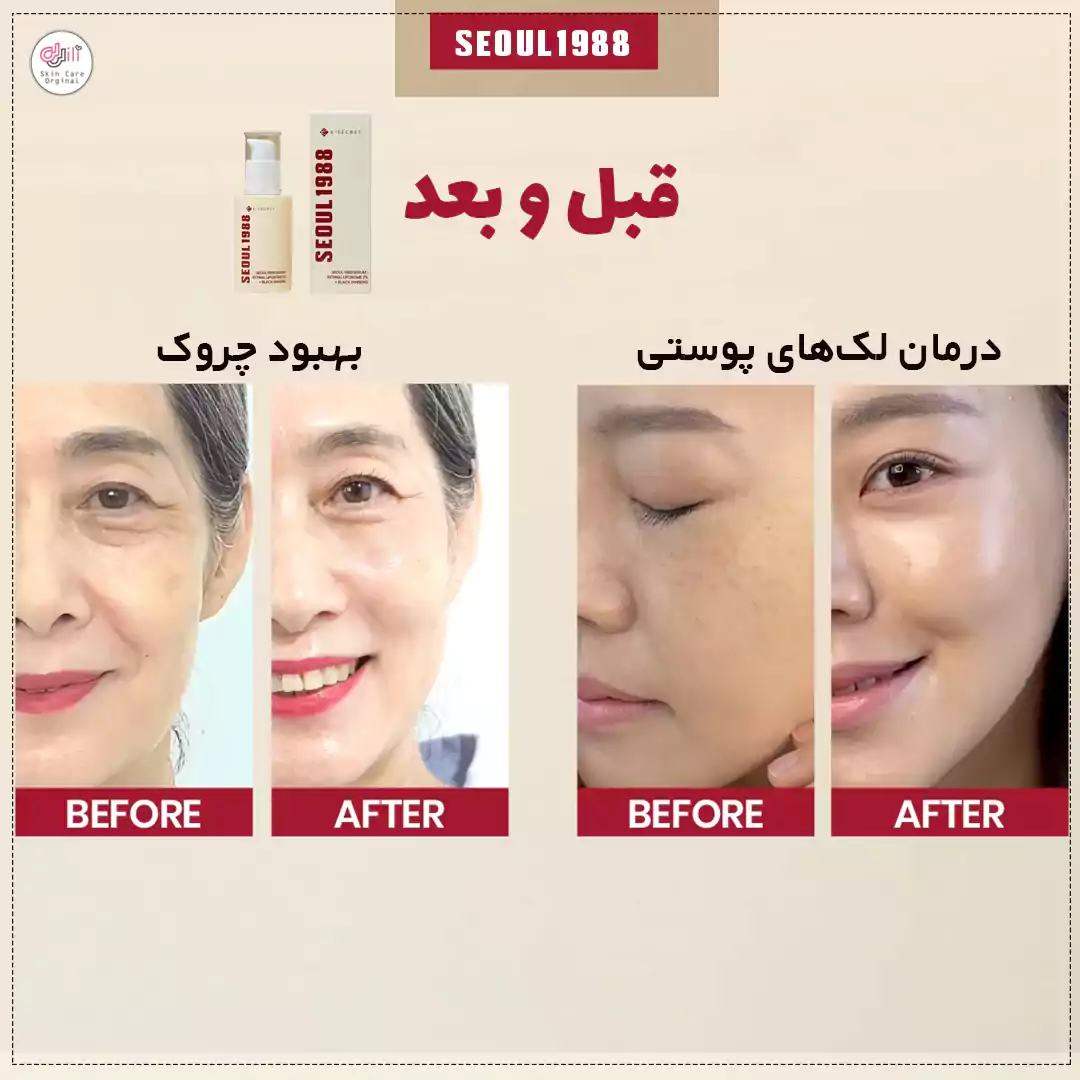 قبل و بعد