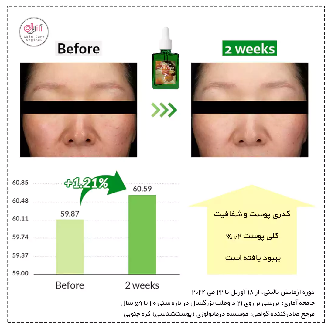 نتیجه سرم ویتامنین سی ملایم
