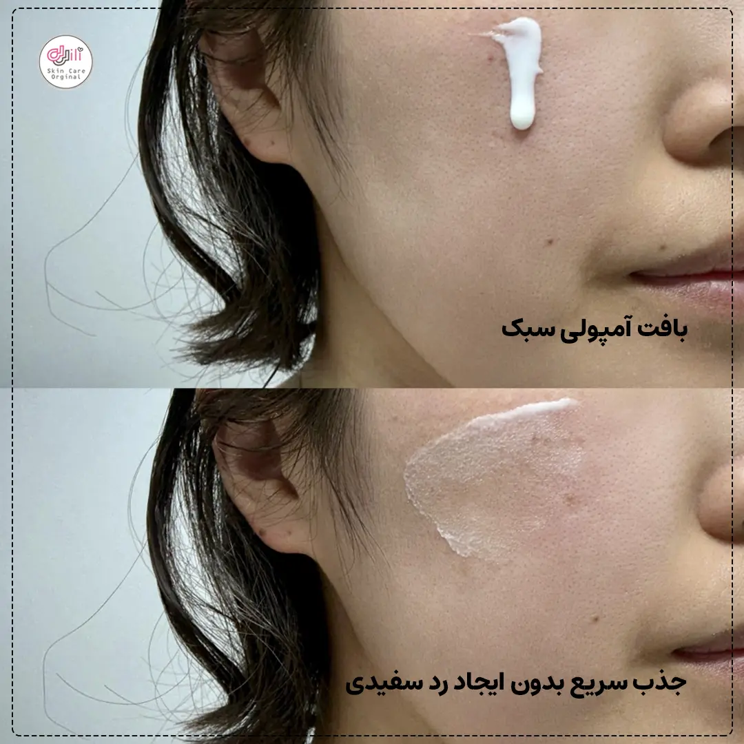 قبل و بعد