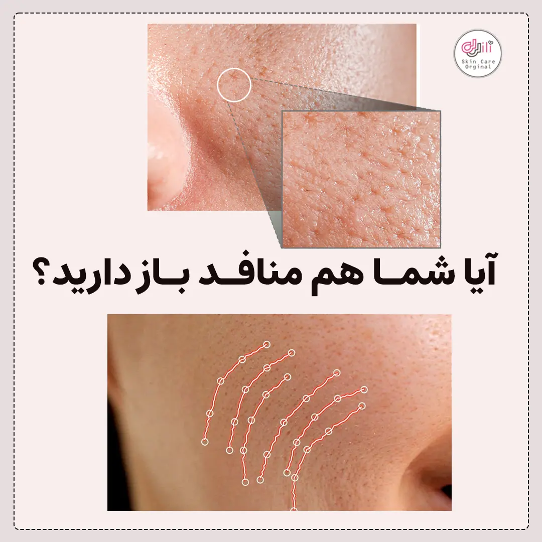 منافد باز پوستی