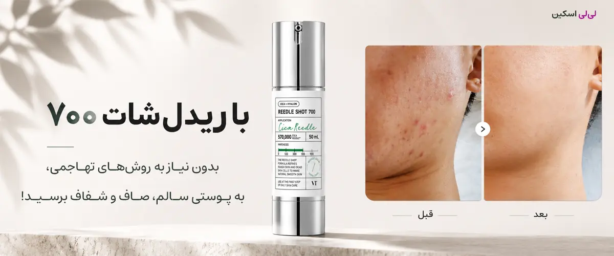 بنر ریدل شات