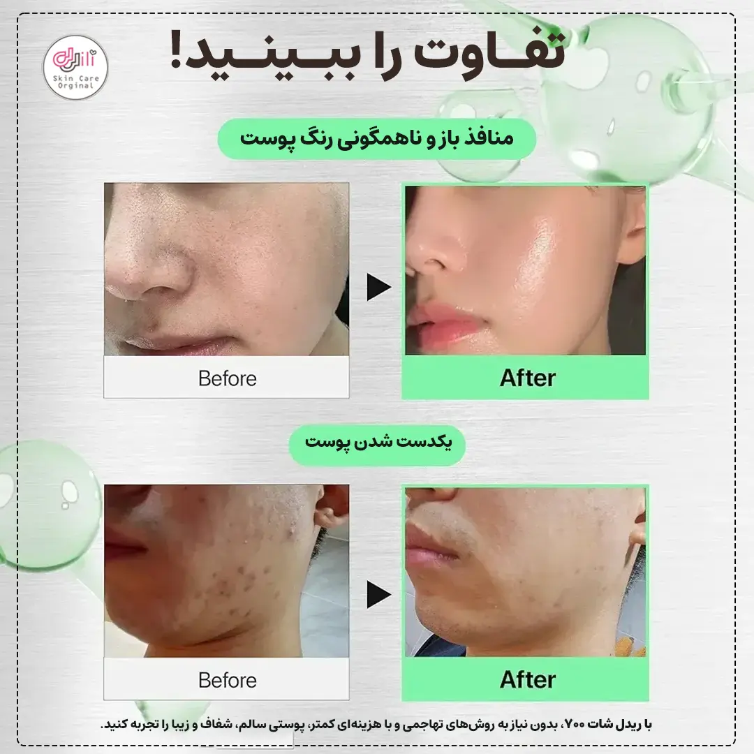 نتایج استفاده از ریدل شات