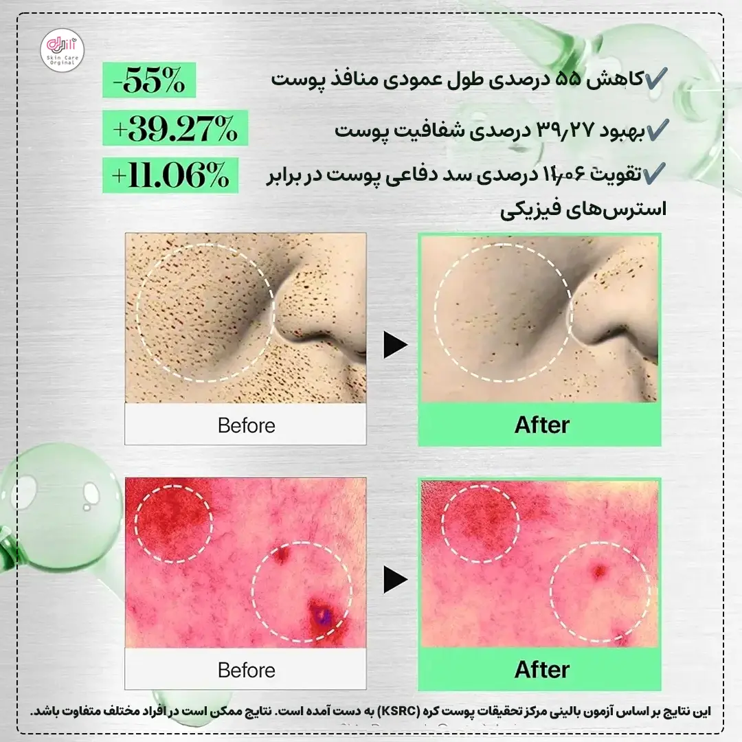 نتایج کلینیکی ریدل شات